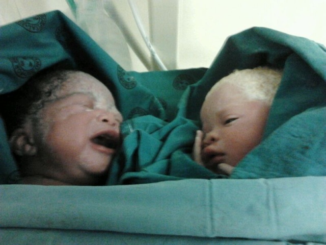 Newly born twins